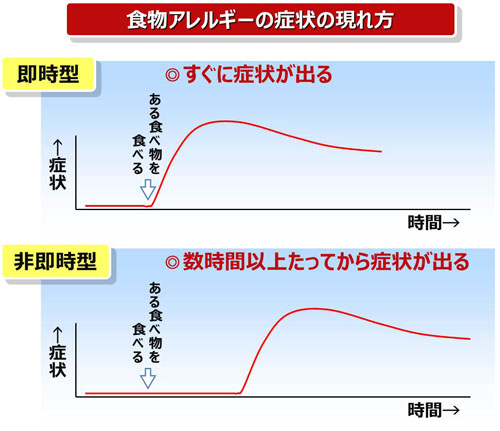 食物アレルギーの症状の現れ方