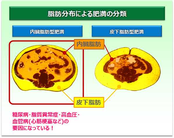 脂肪分布による肥満の分類